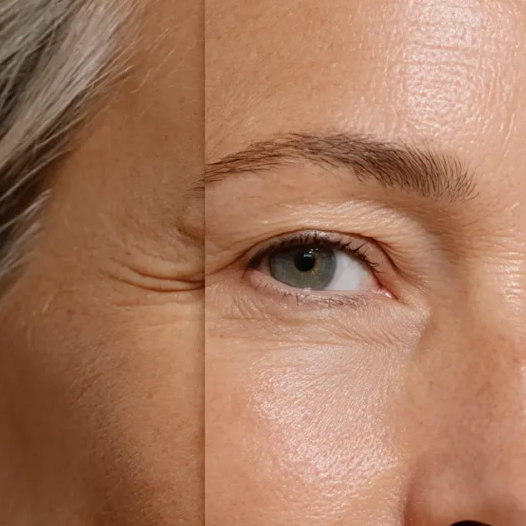 Welche Peptide sind besonders effektiv?